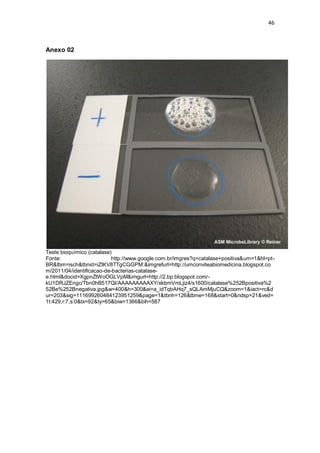 46 
Anexo 02 
Teste bioquímico (catalase) 
Fonte: http://www.google.com.br/imgres?q=catalase+positiva&um=1&hl=pt- BR&tbm=isch&tbnid=iZtKV8TTgCGGPM:&imgrefurl=http://umconviteabiomedicina.blogspot.com/2011/04/identificacao-de-bacterias-catalase- e.html&docid=XgpnZtWoOGLVpM&imgurl=http://2.bp.blogspot.com/- kU1DRJZEngc/Tbn0hB517QI/AAAAAAAAAXY/xkbmVmLjiz4/s1600/catalase%252Bpositiva%252Be%252Bnegativa.jpg&w=400&h=300&ei=a_idTqbAHq7_sQLAmMjuCQ&zoom=1&iact=rc&dur=203&sig=111699260484123951259&page=1&tbnh=126&tbnw=168&start=0&ndsp=21&ved= 1t:429,r:7,s:0&tx=92&ty=65&biw=1366&bih=587 
 