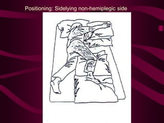 Positioning: Sidelying non-hemiplegic side
 