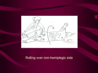 Rolling over non-hemiplegic side
 