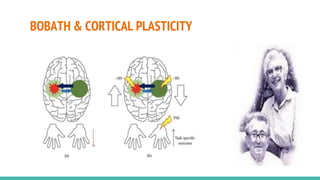 BOBATH & CORTICAL PLASTICITY
 