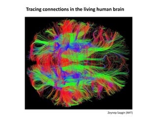 Tracing connections in the living human brain
Zeynep Saygin (MIT)
 