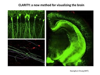 CLARITY: a new method for visualizing the brain
Kwanghun Chung (MIT)
 