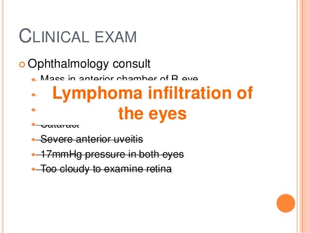 lymphosarcoma in dogs