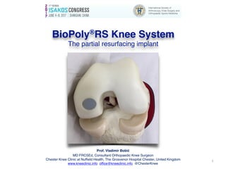 Prof. Vladimir Bobić
MD FRCSEd, Consultant Orthopaedic Knee Surgeon
Chester Knee Clinic at Nuffield Health, The Grosvenor Hospital Chester, United Kingdom
www.kneeclinic.info office@kneeclinic.info @ChesterKnee
BioPoly®RS Knee System  
The partial resurfacing implant
1
 