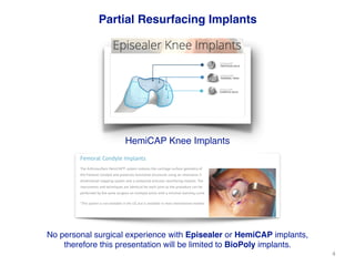 Bobic Vladimir - Partial resurfacing - SICOT Montreal 12th October 2018 ...