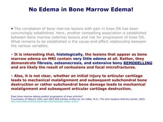 No Edema in Bone Marrow Edema!
• The correlation of bone marrow lesions with pain in knee OA has been
convincingly established. Here, another compelling association is established
between bone marrow (edema) lesions and risk for progression of knee OA.
What remains to be established is the cause-and-effect relationship between
the various variables.
• It is interesting that, histologically, the lesions that appear as bone
marrow edema on MRI contain very little edema at all. Rather, they
demonstrate fibrosis, osteonecrosis, and extensive bony REMODELLING
and are likely the result of contusions and focal microfractures.
• Also, it is not clear, whether an initial injury to articular cartilage
leads to mechanical malalignment and subsequent subchondral bone
destruction or rather subchondral bone damage leads to mechanical
malalignment and subsequent articular cartilage destruction.
Does bone marrow edema predict progression of knee arthritis?
A summary of Felson’s 2001 and 2003 AIM articles written by Jon Gilles, M.D., The John Hopkins Arthritis Center, 2003.
http://www.hopkins-arthritis.org/arthritis-news/2003/bone_edema_oa.html
 