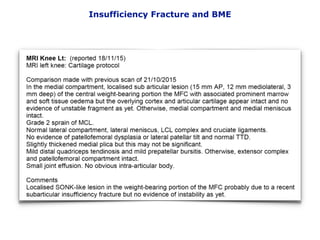 Insufficiency Fracture and BME
 