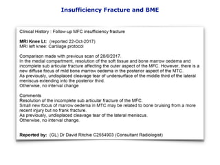 Insufficiency Fracture and BME
 