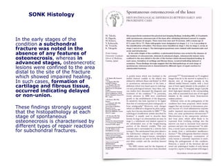 SONK Histology
In the early stages of the
condition a subchondral
fracture was noted in the
absence of any features of
osteonecrosis, whereas in
advanced stages, osteonecrotic
lesions were confined to the area
distal to the site of the fracture
which showed impaired healing.
In such cases, formation of
cartilage and fibrous tissue,
occurred indicating delayed
or non-union.
These findings strongly suggest
that the histopathology at each
stage of spontaneous
osteonecrosis is characterised by
different types of repair reaction
for subchondral fractures.
 