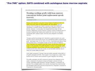 “Pre-TKR” option: OATS combined with autologous bone marrow aspirate
 