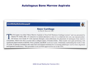 Autologous Bone Marrow Aspirate
AANA Annual Meeting San Francisco 2011
 