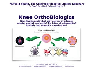 Knee OrthoBiologics
New developments which may delay or avoid more
invasive surgical treatments? The future of orthopaedics?
Basically, less carpentry, more biology?
Prof. Vladimir Bobić, MD FRCS Ed
Chester Knee Clinic www.kneeclinic.info office@kneeclinic.info @ChesterKnee
Nuffield Health, The Grosvenor Hospital Chester Seminars
St. David’s Park Hotel, Ewloe, 6th May 2017
 