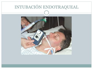 INTUBACIÓN ENDOTRAQUEAL
 