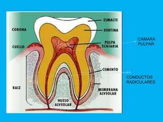 CAMARA PULPAR CONDUCTOS  RADICULARES 