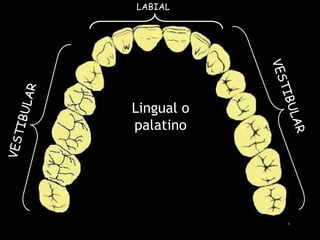 LABIAL VESTIBULAR VESTIBULAR Lingual o palatino 