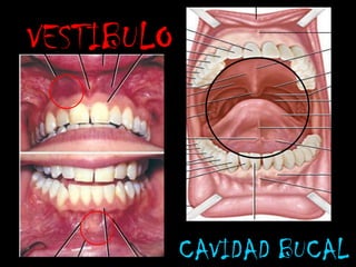 VESTIBULO CAVIDAD BUCAL 