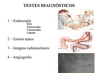 TESTES DIAGNÓSTICOS
1 – Endoscopia
2 – Enema opaco
3 – Imagens radionucleares
4 – Angiografia
EDA
Enteroscopia
Colonoscopia
Cápsula
 