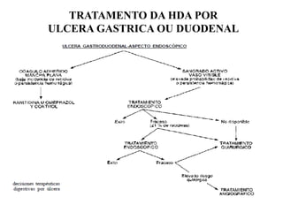 TRATAMENTO DA HDA POR
ULCERA GASTRICA OU DUODENAL
 