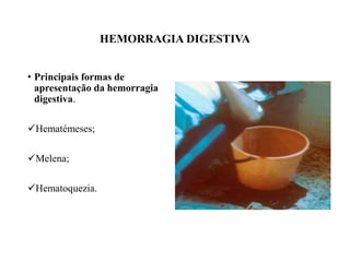 HEMORRAGIA DIGESTIVA
• Principais formas de
apresentação da hemorragia
digestiva.
Hematémeses;
Melena;
Hematoquezia.
 
