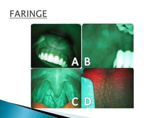 Boca y faringe 
