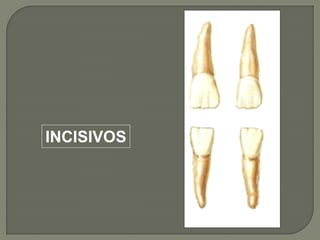 INCISIVOS
 