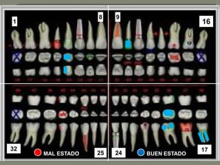 8    9
1                                         16




32                                        17
     MAL ESTADO   25   24   BUEN ESTADO
 