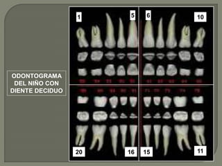 1     5    6   10




ODONTOGRAMA
 DEL NIÑO CON
DIENTE DECIDUO




                 20   16   15   11
 