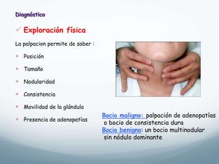  Exploración física
La palpacion permite de saber :
 Posición
 Tamaño
 Nodularidad
 Consistencia
 Movilidad de la glándula
 Presencia de adenopatías
Bocio maligno: palpación de adenopatías
o bocio de consistencia dura
Bocio benigno: un bocio multinodular
sin nódulo dominante
 