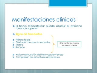 Manifestaciones clínicas
 El bocio retroesternal puede obstruir el estrecho
torácico superior
 Signo de Pemberton
 Plétora facial
 Dilatación de venas cervicales
 Mareo
 Sincope
 Indica obstrucción del flujo yugular venoso
 Compresión de estructuras adyacentes
Al levantar los brazos
sobre la cabeza
 