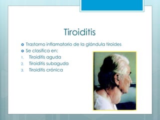 Tiroiditis
 Trastorno inflamatorio de la glándula tiroides
 Se clasifica en:
1. Tiroiditis aguda
2. Tiroiditis subaguda
3. Tiroiditis crónica
 