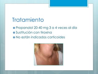 Tratamiento
 Propanolol 20-40 mg 3 a 4 veces al día
 Sustitución con tiroxina
 No están indicados corticoides
 