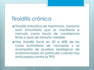 Tiroiditis crónica
 Tiroiditis linfocítica de Hashimoto, trastorno
auto inmunitario que se manifiesta a
menudo como bocio de consistencia
firme o dura de tamaño variable
 Hay tiroiditis focal en 20 a 40% de los
casos eutiroideos de necropsia y se
acompaña de pruebas serológicas de
autoinmunidad, en particular cuando hay
anticuerpos contra la TPO
 