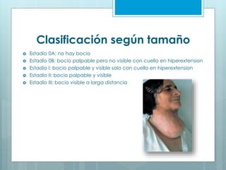 Clasificación según tamaño
 Estadio 0A: no hay bocio
 Estadio 0B: bocio palpable pero no visible con cuello en hiperextension
 Estadio I: bocio palpable y visible solo con cuello en hiperextension
 Estadio II: bocio palpable y visible
 Estadio III: bocio visible a larga distancia
 