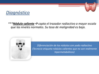Diagnóstico
***Nódulo caliente capta el trazador radiactivo a mayor escala
que los niveles normales. Su tasa de malignidad es baja.
Diferenciación de los nódulos con yodo radiactivo
(Tecnecio etiqueta nódulos calientes que no son realmente
hipermetabólicos)
 