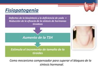 Fisiopatogenia
Como mecanismo compensador para superar el bloqueo de la
síntesis hormonal.
Estimula el incremento de tamaño de la
tiroides
Aumento de la TSH
Defectos de la biosíntesis y la deficiencia de yodo +
Reducción de la eficacia de la síntesis de hormonas
tiroideas
 