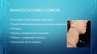 MANIFESTACIONES CLÍNICAS
• Si el bocio tiene tamaño suficiente:
• Puede finalmente provocar síntomas comprensivos como:
• Disfagia .
• Disnea ( comprensión traqueal).
• Plétora ( congestión venosa ).
• Desviación de la tráquea.
 
