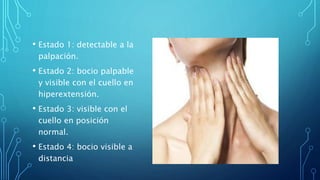 • Estado 1: detectable a la
palpación.
• Estado 2: bocio palpable
y visible con el cuello en
hiperextensión.
• Estado 3: visible con el
cuello en posición
normal.
• Estado 4: bocio visible a
distancia
 