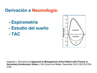 Derivación a Neumología:
- Espirometría
- Estudio del sueño
- TAC

Hegedüs L, Bonnema SJ.Approach to Management of the Patient with Primary or
Secondary Intrathoracic Goiter.J Clin Endocrinol Metab, December 2010, 95(12):5155–
5162

 