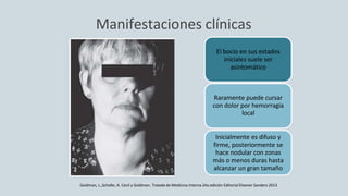 Manifestaciones clínicas
El bocio en sus estados
iniciales suele ser
asintomático
Raramente puede cursar
con dolor por hemorragia
local
Inicialmente es difuso y
firme, posteriormente se
hace nodular con zonas
más o menos duras hasta
alcanzar un gran tamaño
Goldman, L.,Schafer, A. Cecil y Goldman. Tratado de Medicina Interna 24a edición Editorial Elsevier Sanders 2013
 