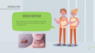 BOCIO DIFUSO
Bocio difuso: crecimiento simétrico de ambos
lóbulos tiroides, sin que se detecten nódulos
a la palpación.
4
INTRODUCTION
 