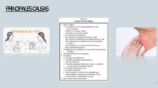 9
PRINCIPALES CAUSAS
 