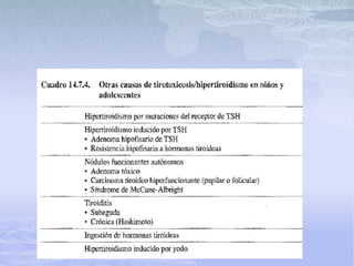 Bocio e hipertiroidismo