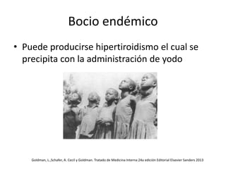 Bocio endémico
• Puede producirse hipertiroidismo el cual se
precipita con la administración de yodo
Goldman, L.,Schafer, A. Cecil y Goldman. Tratado de Medicina Interna 24a edición Editorial Elsevier Sanders 2013
 