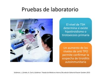 Pruebas de laboratorio
El nivel de TSH
determina si existe
hipotiroidismo o
tirotoxicosis primaria
Un aumento de los
niveles de anti TPO
permite confirmar la
sospecha de tiroiditis
autoinmunitaria
Goldman, L.,Schafer, A. Cecil y Goldman. Tratado de Medicina Interna 24a edición Editorial Elsevier Sanders 2013
 