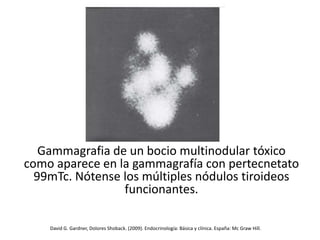 Gammagrafia de un bocio multinodular tóxico
como aparece en la gammagrafía con pertecnetato
99mTc. Nótense los múltiples nódulos tiroideos
funcionantes.
David G. Gardner, Dolores Shoback. (2009). Endocrinología: Básica y clínica. España: Mc Graw Hill.
 