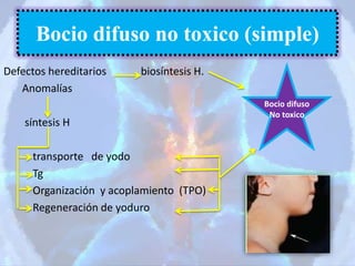 Defectos hereditarios biosíntesis H.
Anomalías
síntesis H
transporte de yodo
Tg
Organización y acoplamiento (TPO)
Regeneración de yoduro
Bocio difuso no toxico (simple)
Bocio difuso
No toxico
 