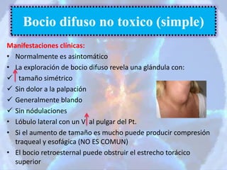 Manifestaciones clínicas:
• Normalmente es asintomático
• La exploración de bocio difuso revela una glándula con:
 tamaño simétrico
 Sin dolor a la palpación
 Generalmente blando
 Sin nódulaciones
• Lóbulo lateral con un V al pulgar del Pt.
• Si el aumento de tamaño es mucho puede producir compresión
traqueal y esofágica (NO ES COMUN)
• El bocio retroesternal puede obstruir el estrecho torácico
superior
Bocio difuso no toxico (simple)
 