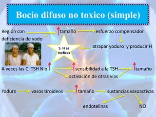 Región con tamaño esfuerzo compensador
deficiencia de yodo
atrapar yoduro y producir H
A veces las C. TSH N o sensibilidad a la TSH tamaño
activación de otras vías
Yoduro vasos tiroideos tamaño sustancias vasoactivas
endotelinas NO
Bocio difuso no toxico (simple)
S. H es
Ineficaz
 