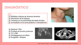 DIAGNÓSTICO
 Medición TSH
 Pruebas de función pulmonar
 TC o RM
 Esofagograma con Bario
 Ecografía + Biopsia
EF:
 Múltiples nódulos de diversos tamaños
 Desviación de la tráquea
 inmersos en la profundidad del tejido tiroideo
 se localizan en la zona posterior o retroesternal
Longo D, Kasper D, Jameson J. . (2012). Harrison. principios de medicina interna. Mexico, DF: McGrawHill.
 