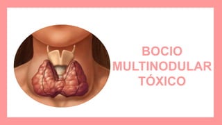 BOCIO
MULTINODULAR
TÓXICO
 